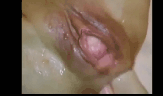 best of Urethra sounding creamy vagina