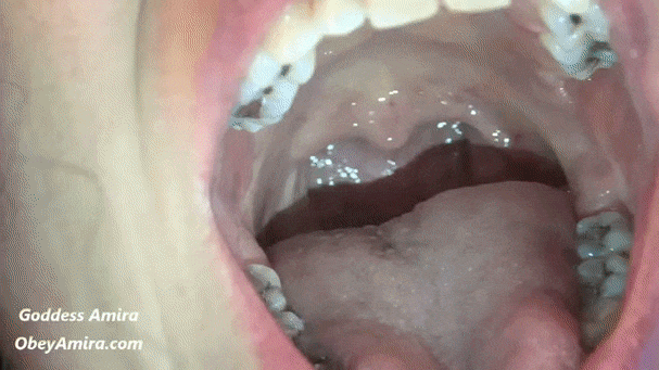 Light Y. reccomend teeth tongue mouth checks uvula